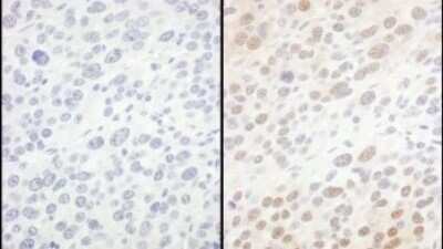Immunohistochemistry: integrin beta 4 binding protein Antibody [NBP1-52641]