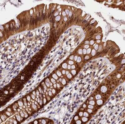 Immunohistochemistry-Paraffin: integrin beta 4 binding protein Antibody [NBP2-13954]