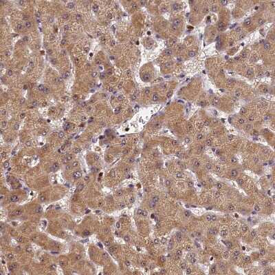 Immunohistochemistry-Paraffin: integrin beta 4 binding protein Antibody [NBP2-13954]