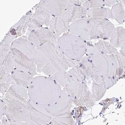 Immunohistochemistry-Paraffin: integrin beta 4 binding protein Antibody [NBP2-13954]
