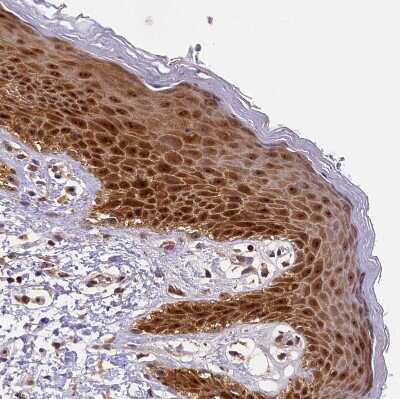 Immunohistochemistry-Paraffin: integrin beta 4 binding protein Antibody [NBP2-13954]