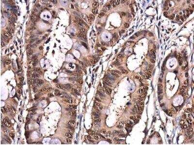 Immunohistochemistry-Paraffin: integrin beta 4 binding protein Antibody [NBP2-16975]