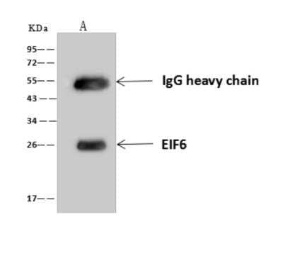 Immunoprecipitation: integrin beta 4 binding protein Antibody [NBP3-06333]
