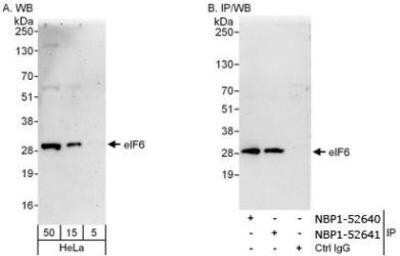 Western Blot: integrin beta 4 binding protein Antibody [NBP1-52640]