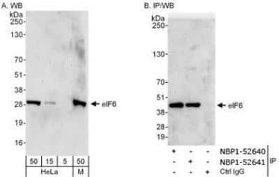 Western Blot: integrin beta 4 binding protein Antibody [NBP1-52641]