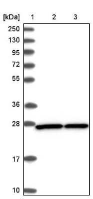 Western Blot: integrin beta 4 binding protein Antibody [NBP2-13954]