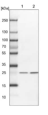 Western Blot: integrin beta 4 binding protein Antibody [NBP2-13954]