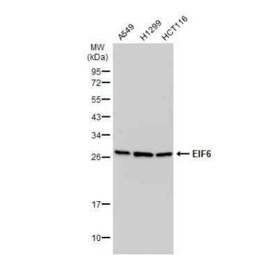 Western Blot: integrin beta 4 binding protein Antibody [NBP2-16975]