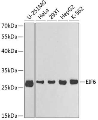 Western Blot: integrin beta 4 binding protein AntibodyBSA Free [NBP3-03384]