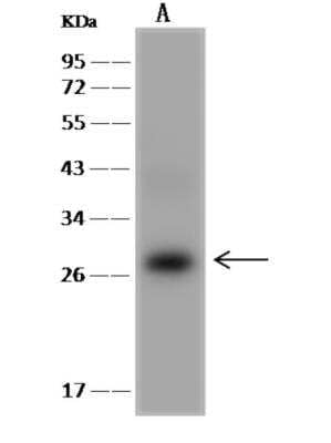 Western Blot: integrin beta 4 binding protein Antibody [NBP3-06333]