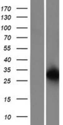 Western Blot: integrin beta 4 binding protein Overexpression Lysate [NBP2-04928]