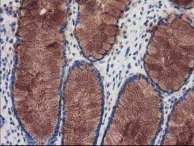 Immunohistochemistry-Paraffin: katanin-p80 Antibody (OTI5C4) [NBP2-01383]