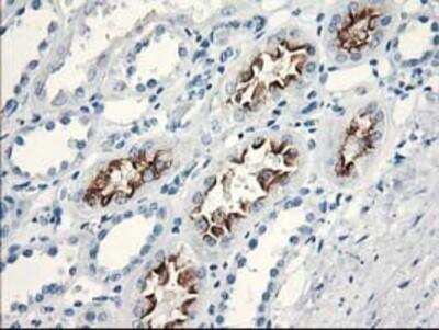 Immunohistochemistry-Paraffin: katanin-p80 Antibody (OTI5C4) [NBP2-01383]