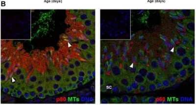 Immunocytochemistry/ Immunofluorescence: katanin-p80 Antibody [NBP1-87413]