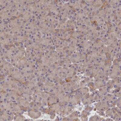 Immunohistochemistry-Paraffin: katanin-p80 Antibody [NBP1-87413]