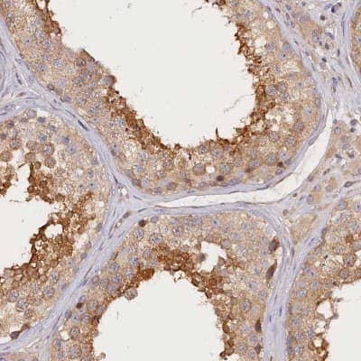 Immunohistochemistry-Paraffin: katanin-p80 Antibody [NBP1-87413]