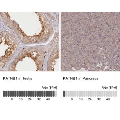 Immunohistochemistry-Paraffin: katanin-p80 Antibody [NBP1-87413]