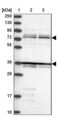 Western Blot: katanin-p80 Antibody [NBP1-87413]