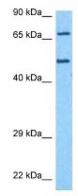 Western Blot: katanin-p80 Antibody [NBP3-10015]