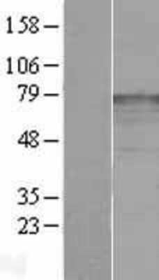 Western Blot: katanin-p80 Overexpression Lysate [NBL1-12130]