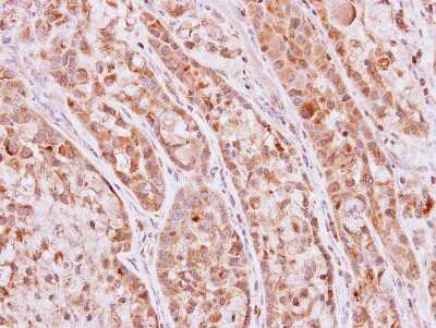 Immunohistochemistry-Paraffin: Ketohexokinase Antibody [NBP1-32778]
