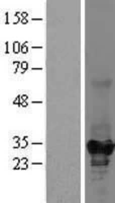 Western Blot: Ketohexokinase Overexpression Lysate [NBL1-12232]