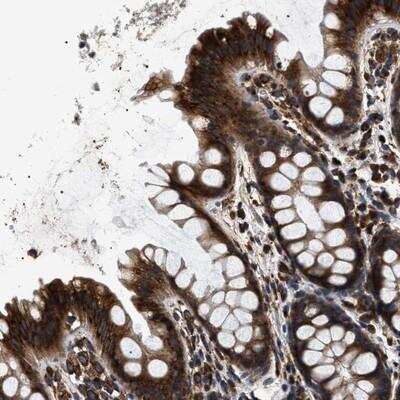 Immunohistochemistry: kinectin Antibody [NBP1-90635]