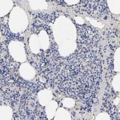 Immunohistochemistry-Paraffin: kinectin Antibody [NBP1-90634]