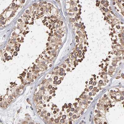 Immunohistochemistry-Paraffin: kinectin Antibody [NBP1-90634]