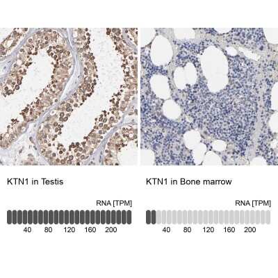 Immunohistochemistry-Paraffin: kinectin Antibody [NBP1-90634]