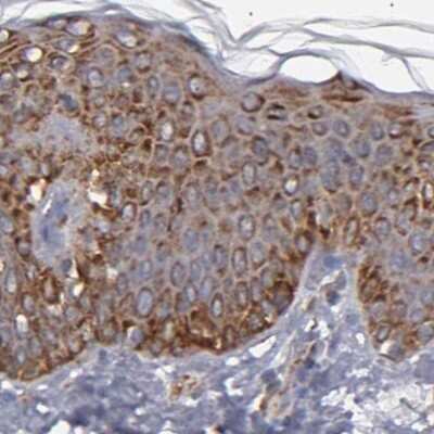 Immunohistochemistry-Paraffin: kinectin Antibody [NBP1-90634]