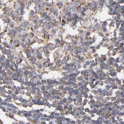 Immunohistochemistry-Paraffin: kinectin Antibody [NBP1-90634]