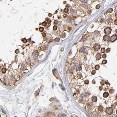 Immunohistochemistry-Paraffin: kinectin Antibody [NBP1-90634]