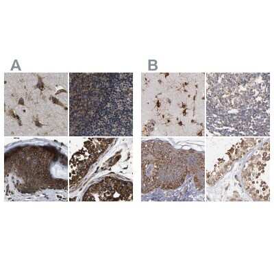 Immunohistochemistry-Paraffin: kinectin Antibody [NBP1-90635]