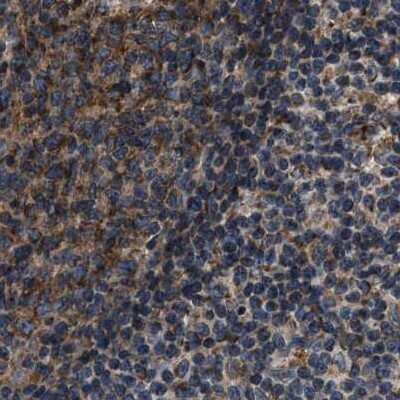 Immunohistochemistry-Paraffin: kinectin Antibody [NBP1-90635]