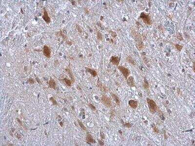 Immunohistochemistry-Paraffin: kinectin Antibody [NBP2-15003]