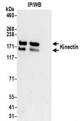 Immunoprecipitation: kinectin Antibody [NBP2-32261]