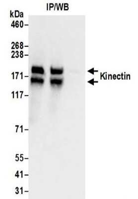 Immunoprecipitation: kinectin Antibody [NBP2-32262]