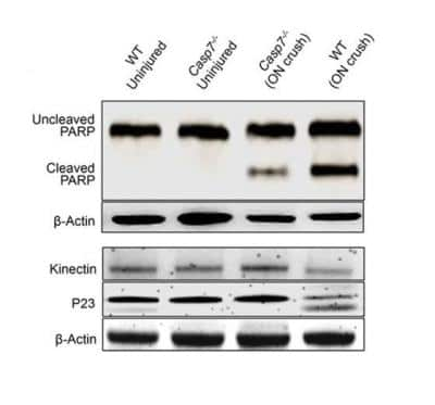 Western Blot: kinectin Antibody [NBP1-91592]