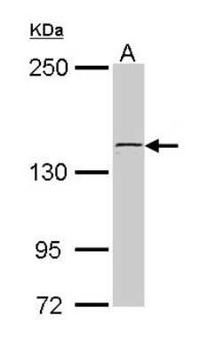 Western Blot: kinectin Antibody [NBP2-15003]