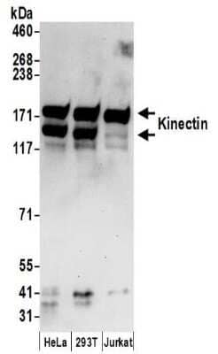 Western Blot: kinectin Antibody [NBP2-32261]