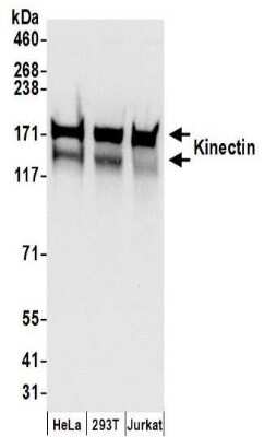 Western Blot: kinectin Antibody [NBP2-32262]