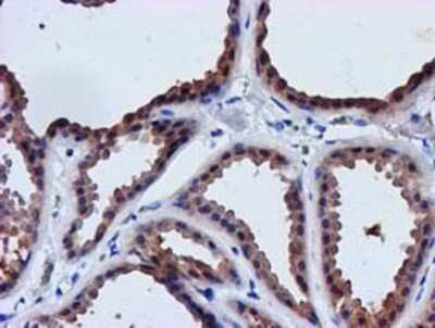 Immunohistochemistry-Paraffin: lactamase, beta 2 Antibody (OTI2F9) [NBP2-00509]