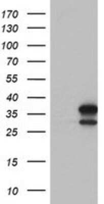 Western Blot: lactamase, beta 2 Antibody (OTI2F9) [NBP2-00509]