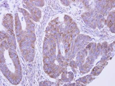 Immunohistochemistry-Paraffin: lactamase, beta 2 Antibody [NBP2-19319]