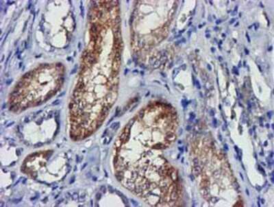 Immunohistochemistry: lactamase, beta 2 Antibody (OTI2F9) - Azide and BSA Free [NBP2-71901]