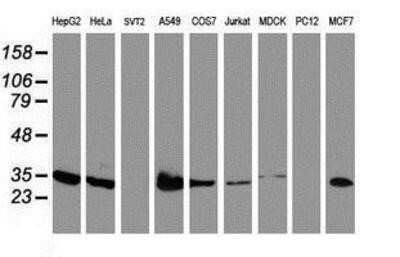 Western Blot: lactamase, beta 2 Antibody (OTI2F9)Azide and BSA Free [NBP2-71901]