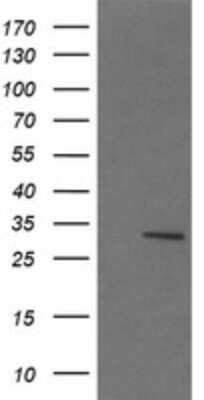 Western Blot: lactamase, beta 2 Antibody (OTI4F7)Azide and BSA Free [NBP2-71903]