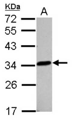 Western Blot: lactamase, beta 2 Antibody [NBP2-19319]