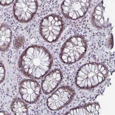 Immunohistochemistry-Paraffin: lin-54 Antibody [NBP2-33794]